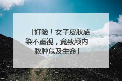 好险！女子皮肤感染不重视，竟致颅内脓肿危及生命